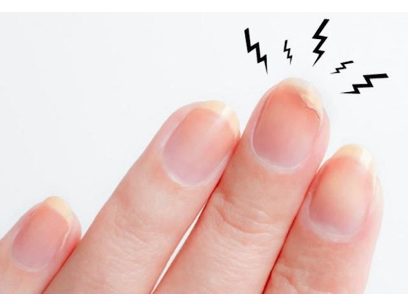 ¿Uñas frágiles, quebradizas? Tenemos la solución!!