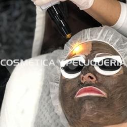 Láser Q-SWITCHED (ND) YAG + Carbón Activo - Imagen 2