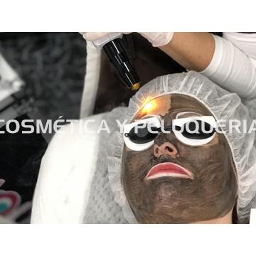 Láser Q-SWITCHED (ND) YAG + Carbón Activo - Imagen 2